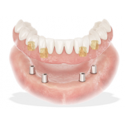 Baza dentara rasina - Lucitone 199 - Sirona
