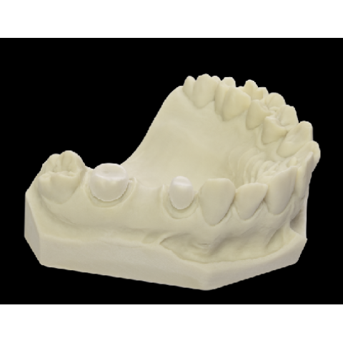 Blank-uri de termoformare - Copings - Dreve