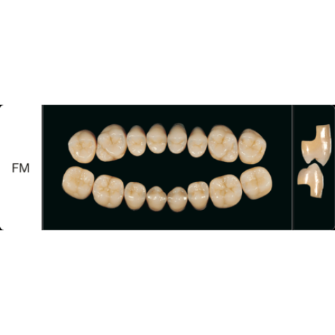 Proteza dentara Creapearl 2 Posterior - FM - Creation Willi Geller