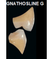 Proteza dentara Creapearl 2 Posterior - GS - Creation Willi Geller