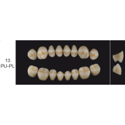 Proteza dentara Creopal - 13 PU-PL - Creation Willi Geller