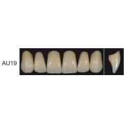 Proteza dentara Creopal - AU19 - Creation Willi Geller