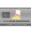 Software inLab SW 20.0 pentru proteze mobile - Sirona
